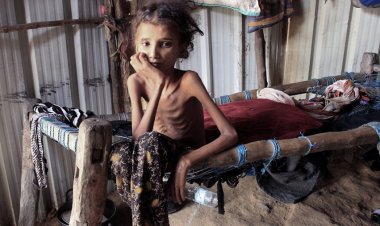 La ONU advirtió del fuerte aumento de la inseguridad alimentaria aguda en el mundo en 2021