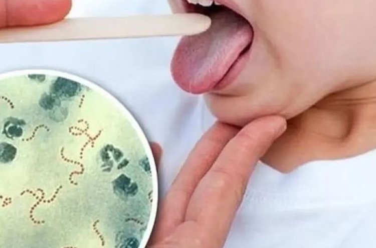 Streptococcus pyogenes: alerta por la cantidad de casos