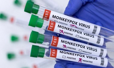 Viruela del mono: ya hay 22 casos confirmados en Argentina