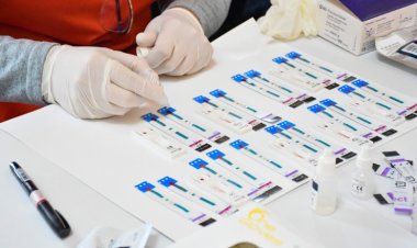Conoce los lugares donde realizan testeos gratuitos de Hepatitis